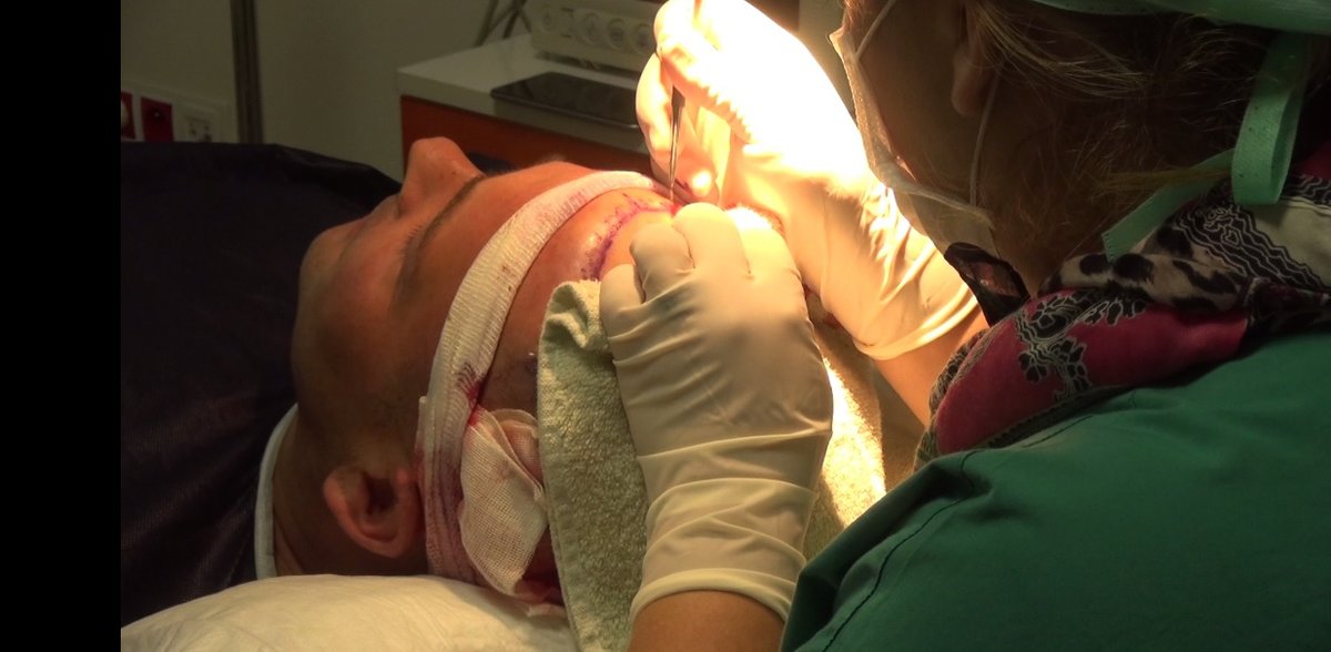 مركز ENTO الطبي عيادة زراعة الشعر - ENTO Medical Center Hair Transplant Clinic