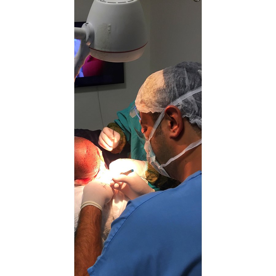 مركز ENTO الطبي عيادة زراعة الشعر - ENTO Medical Center Hair Transplant Clinic