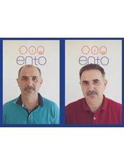 مركز ENTO الطبي عيادة زراعة الشعر - ENTO Medical Center Hair Transplant Clinic