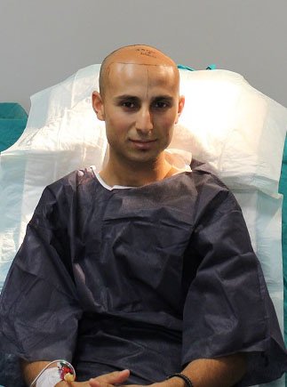 مركز ENTO الطبي عيادة زراعة الشعر - ENTO Medical Center Hair Transplant Clinic