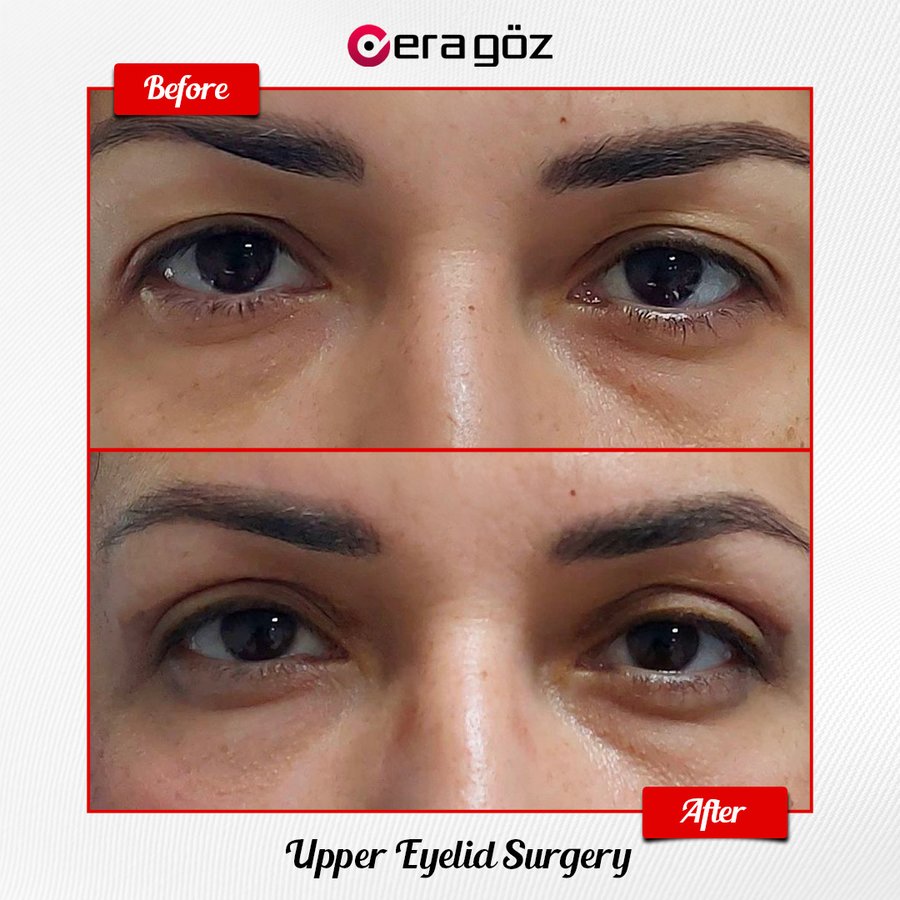 Era Göz Eye Hospital - Era Göz Eye Hospital