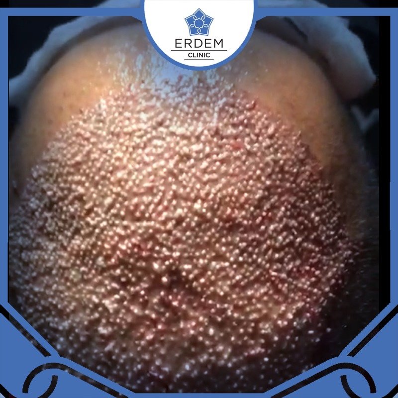 ERDEM CLINIC - ERDEM CLINIC