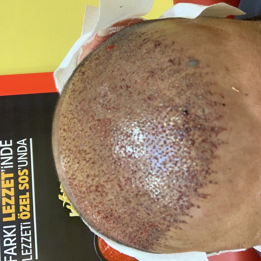 ERDEM CLINIC - ERDEM CLINIC