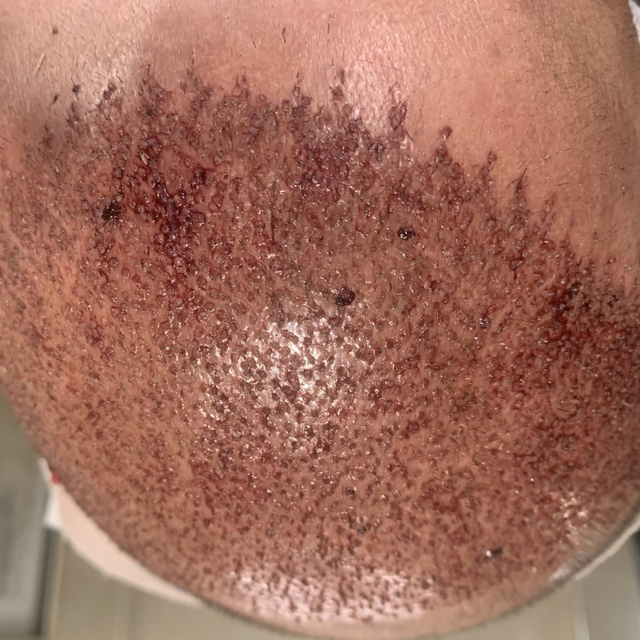 ERDEM CLINIC - ERDEM CLINIC