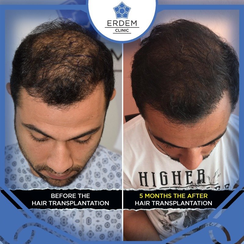 ERDEM CLINIC - ERDEM CLINIC