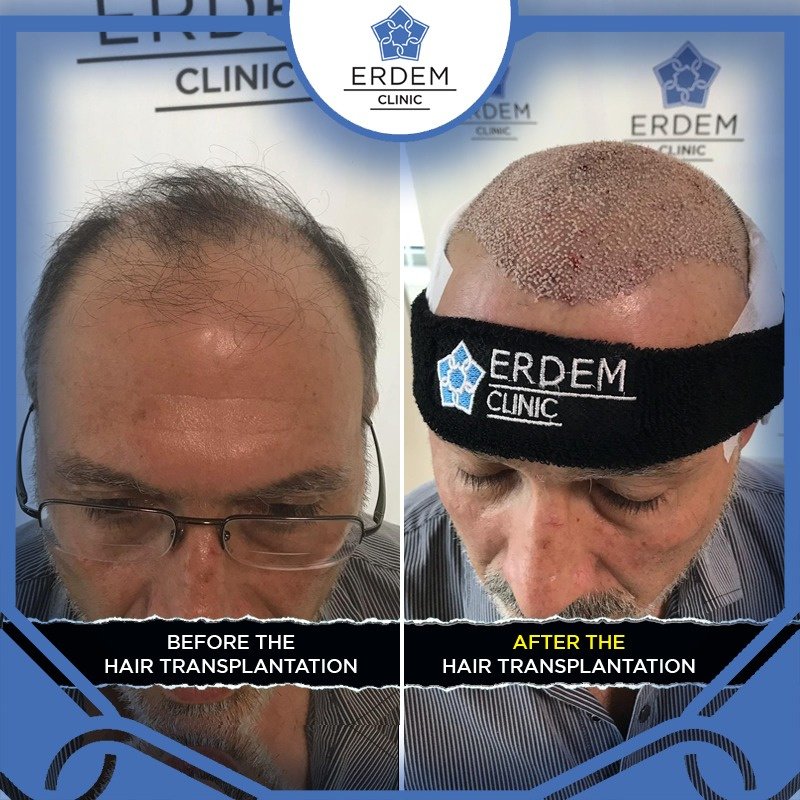 ERDEM CLINIC - ERDEM CLINIC