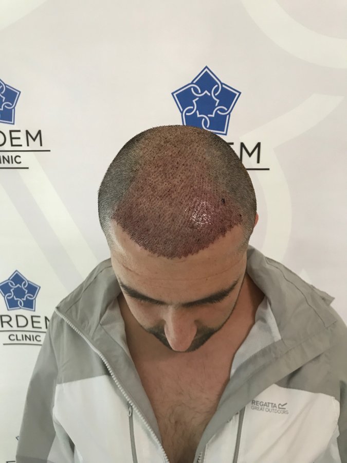 ERDEM CLINIC - ERDEM CLINIC