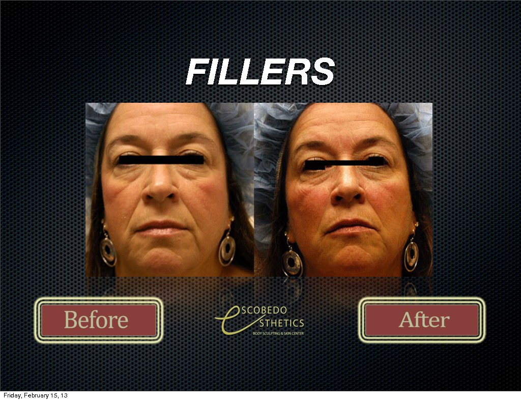 Escobedo Esthetics Body Sculpting & Skin Center - Escobedo Esthetics Body Sculpting & Skin Center