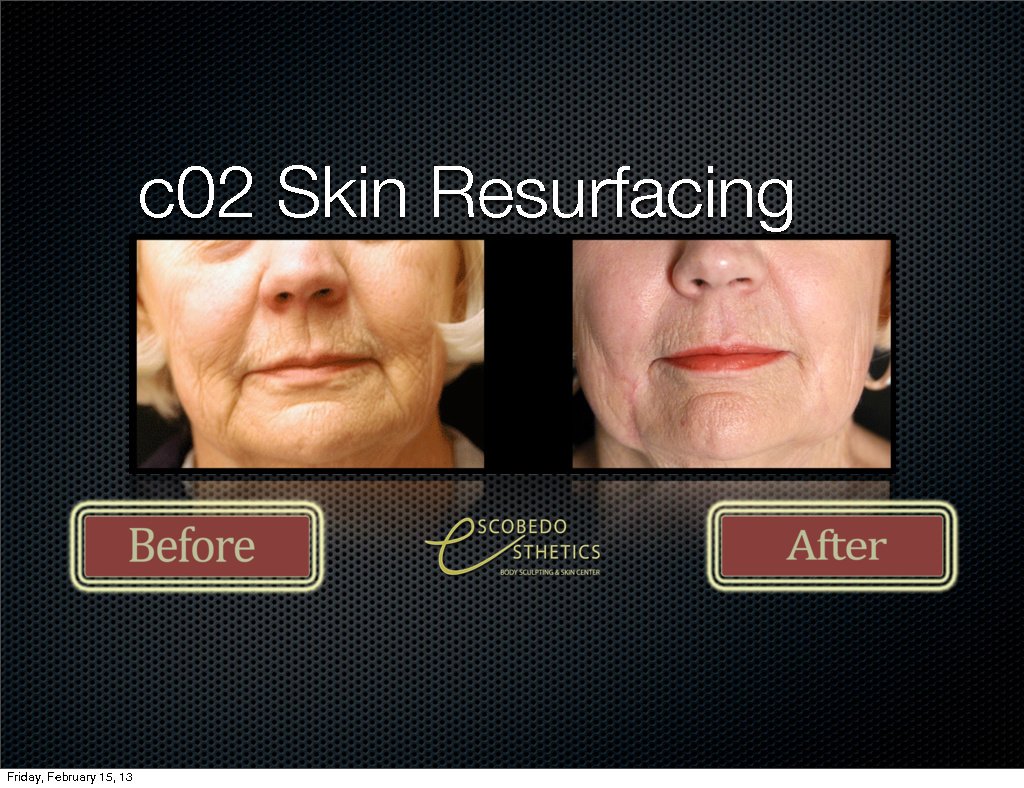 Escobedo Esthetics Body Sculpting & Skin Center - Escobedo Esthetics Body Sculpting & Skin Center