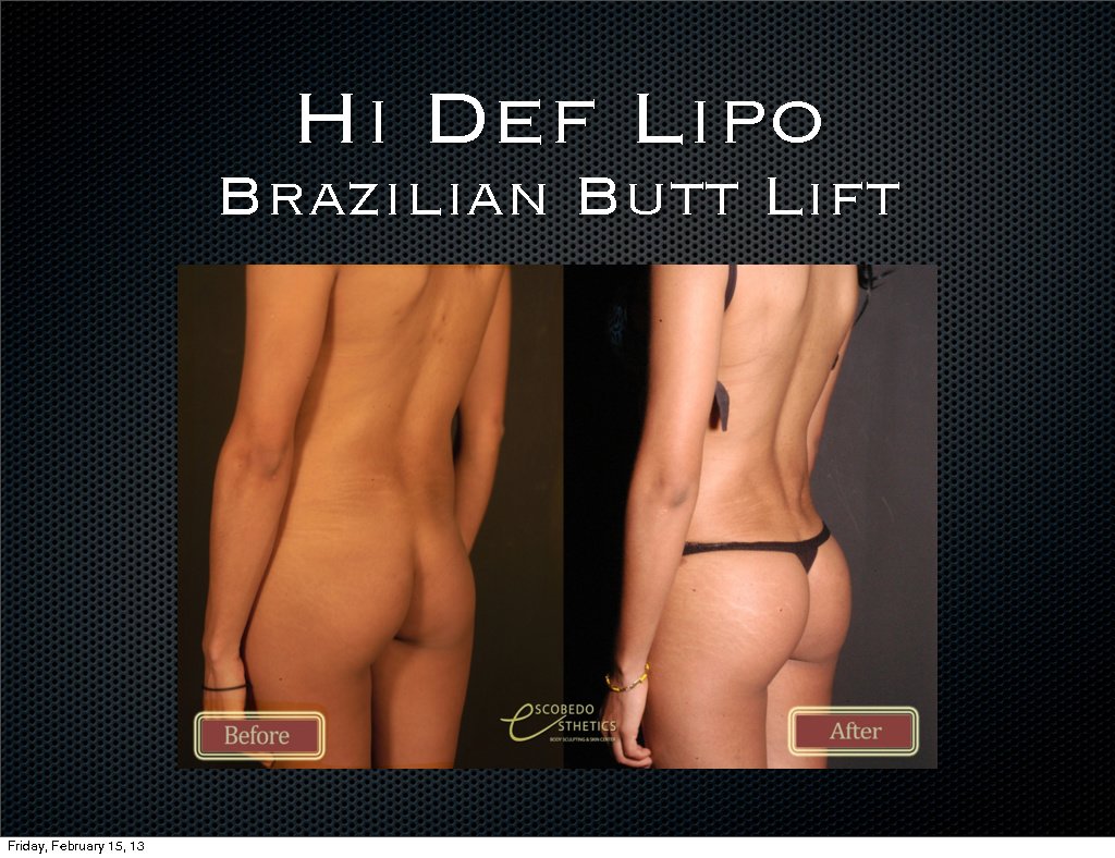 Escobedo Esthetics Body Sculpting & Skin Center - Escobedo Esthetics Body Sculpting & Skin Center