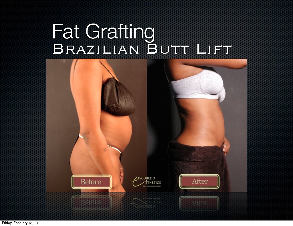 Escobedo Esthetics Body Sculpting & Skin Center - Escobedo Esthetics Body Sculpting & Skin Center