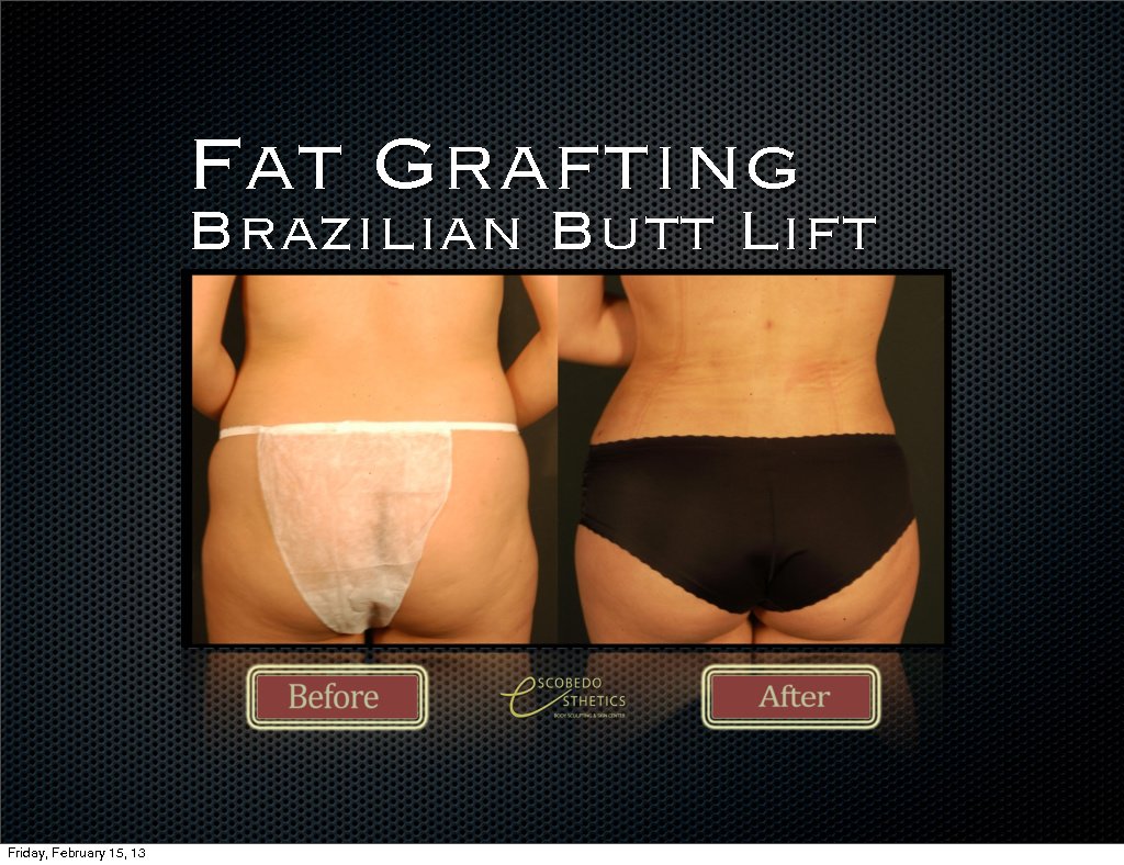 Escobedo Esthetics Body Sculpting & Skin Center - Escobedo Esthetics Body Sculpting & Skin Center
