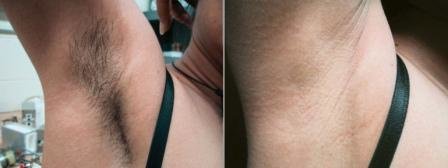 Escobedo Esthetics Body Sculpting & Skin Center - Escobedo Esthetics Body Sculpting & Skin Center