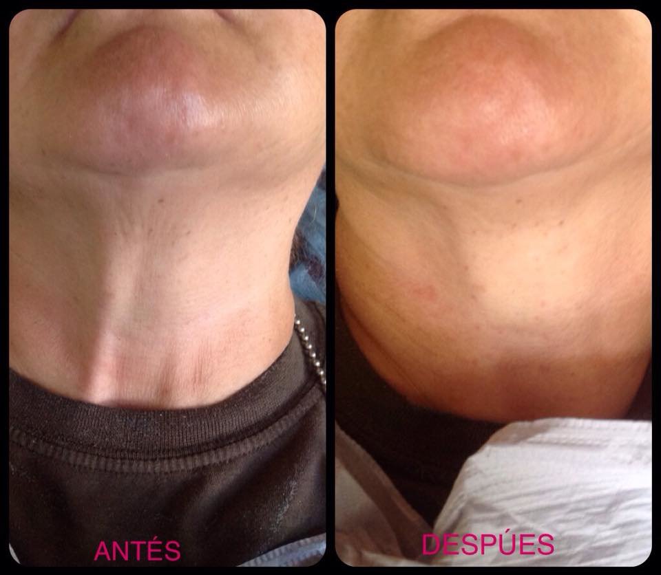 Escobedo Esthetics Body Sculpting & Skin Center - Escobedo Esthetics Body Sculpting & Skin Center