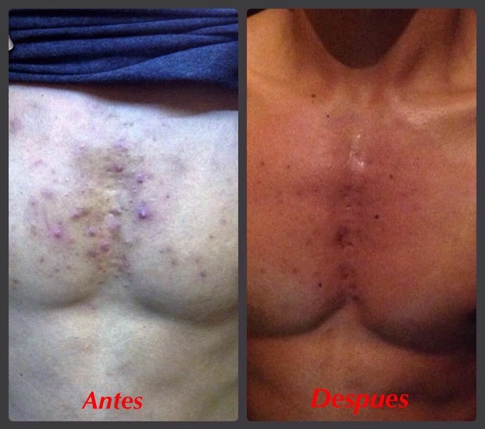 Escobedo Esthetics Body Sculpting & Skin Center - Escobedo Esthetics Body Sculpting & Skin Center