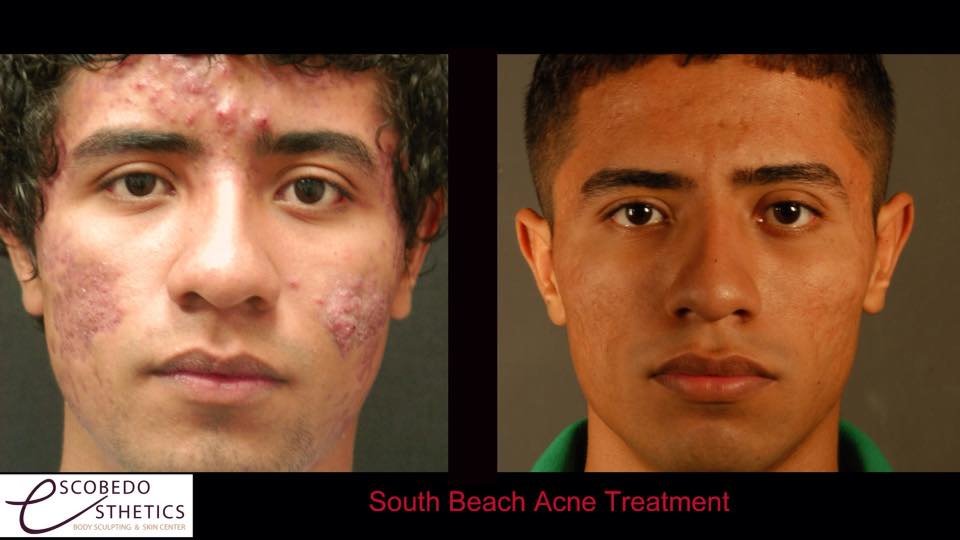 Escobedo Esthetics Body Sculpting & Skin Center - Escobedo Esthetics Body Sculpting & Skin Center