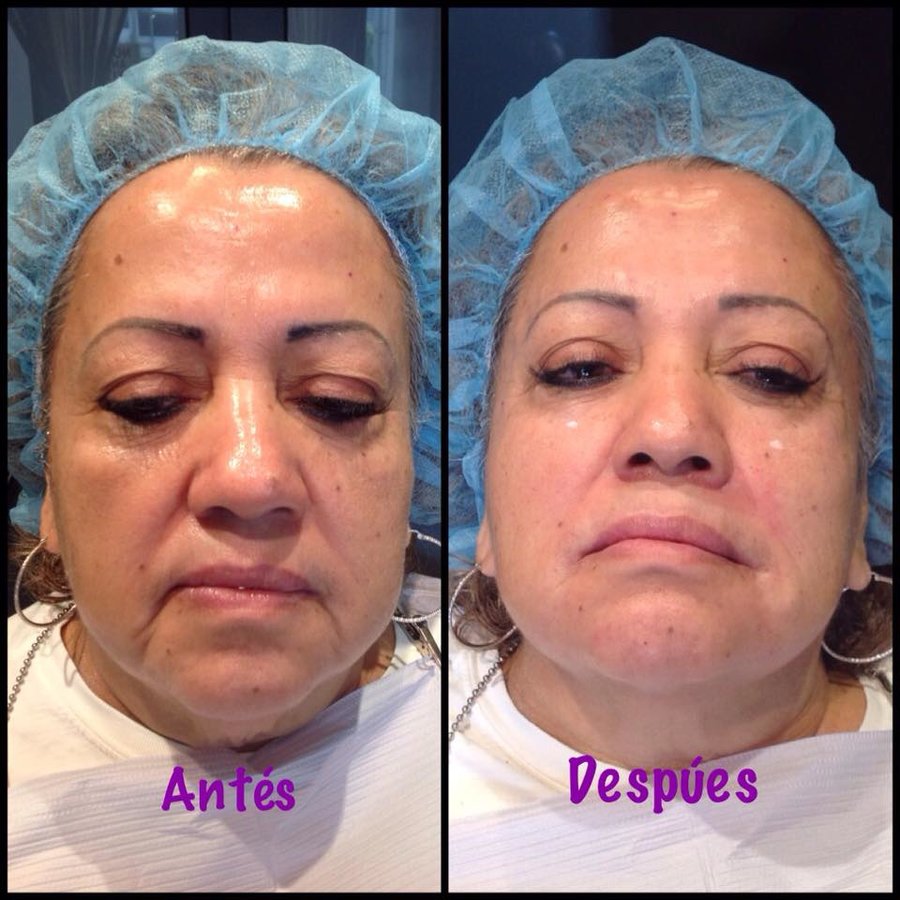Escobedo Esthetics Body Sculpting & Skin Center - Escobedo Esthetics Body Sculpting & Skin Center