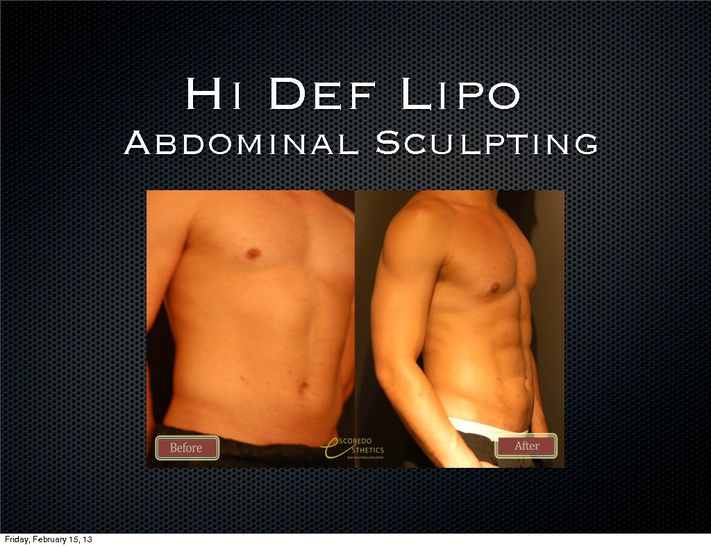 Escobedo Esthetics Body Sculpting & Skin Center - Escobedo Esthetics Body Sculpting & Skin Center