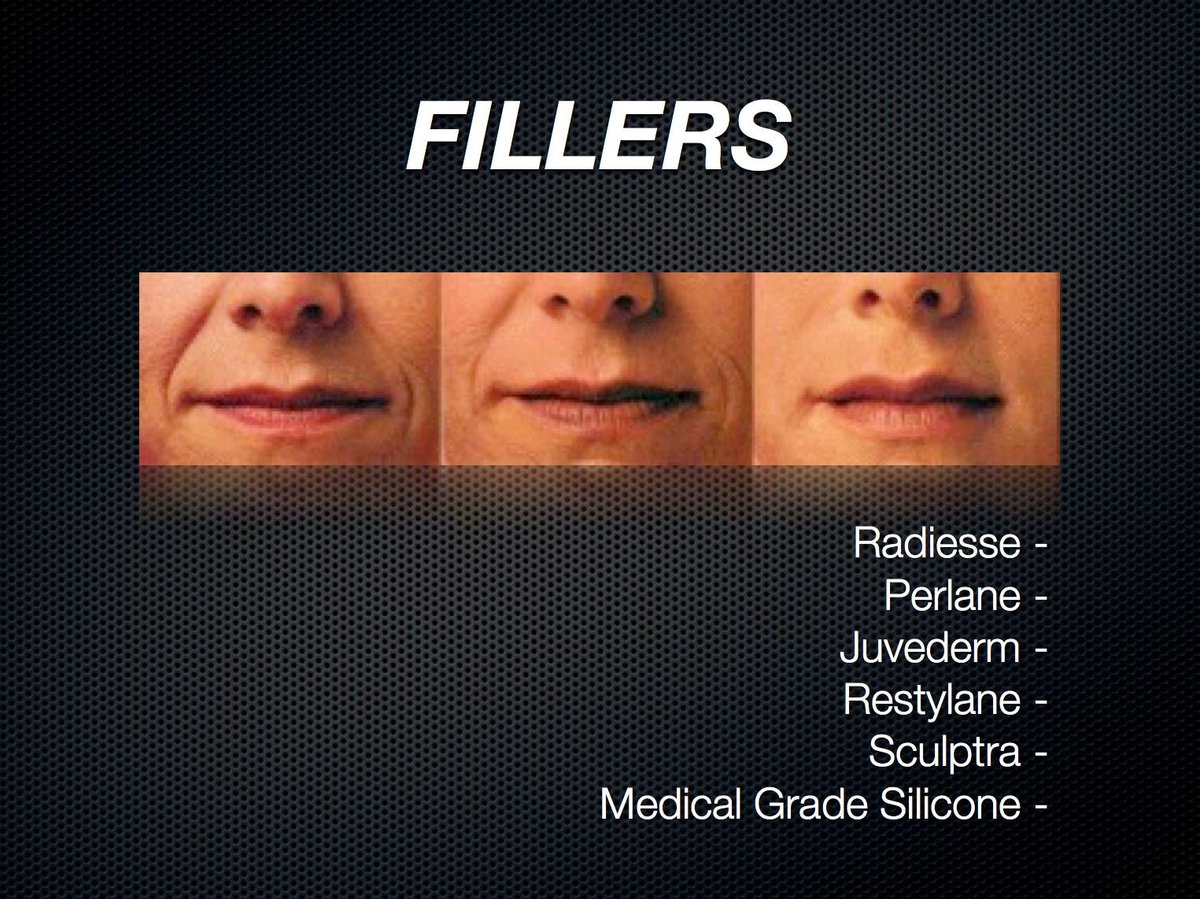 Escobedo Esthetics Body Sculpting & Skin Center - Escobedo Esthetics Body Sculpting & Skin Center