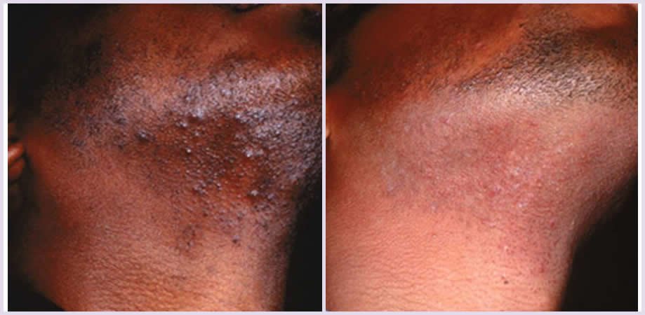 Escobedo Esthetics Body Sculpting & Skin Center - Escobedo Esthetics Body Sculpting & Skin Center