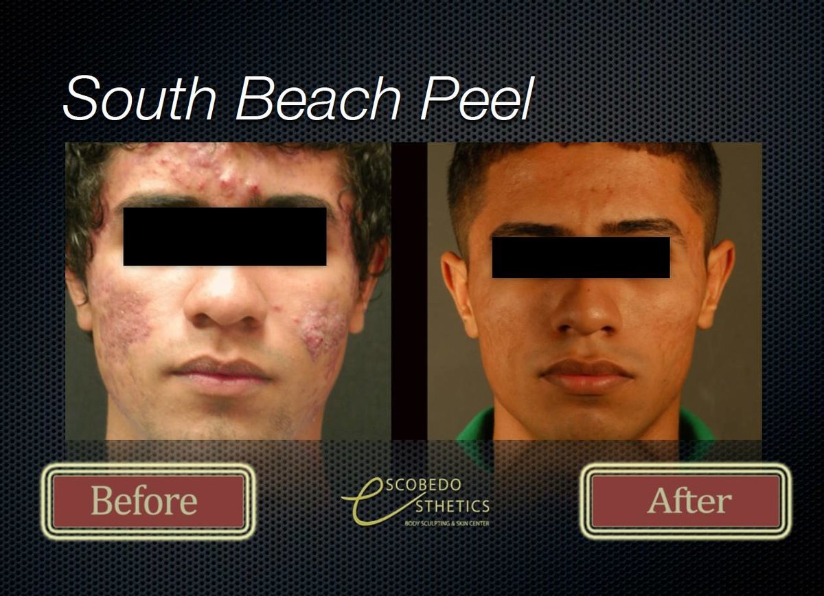 Escobedo Esthetics Body Sculpting & Skin Center - Escobedo Esthetics Body Sculpting & Skin Center