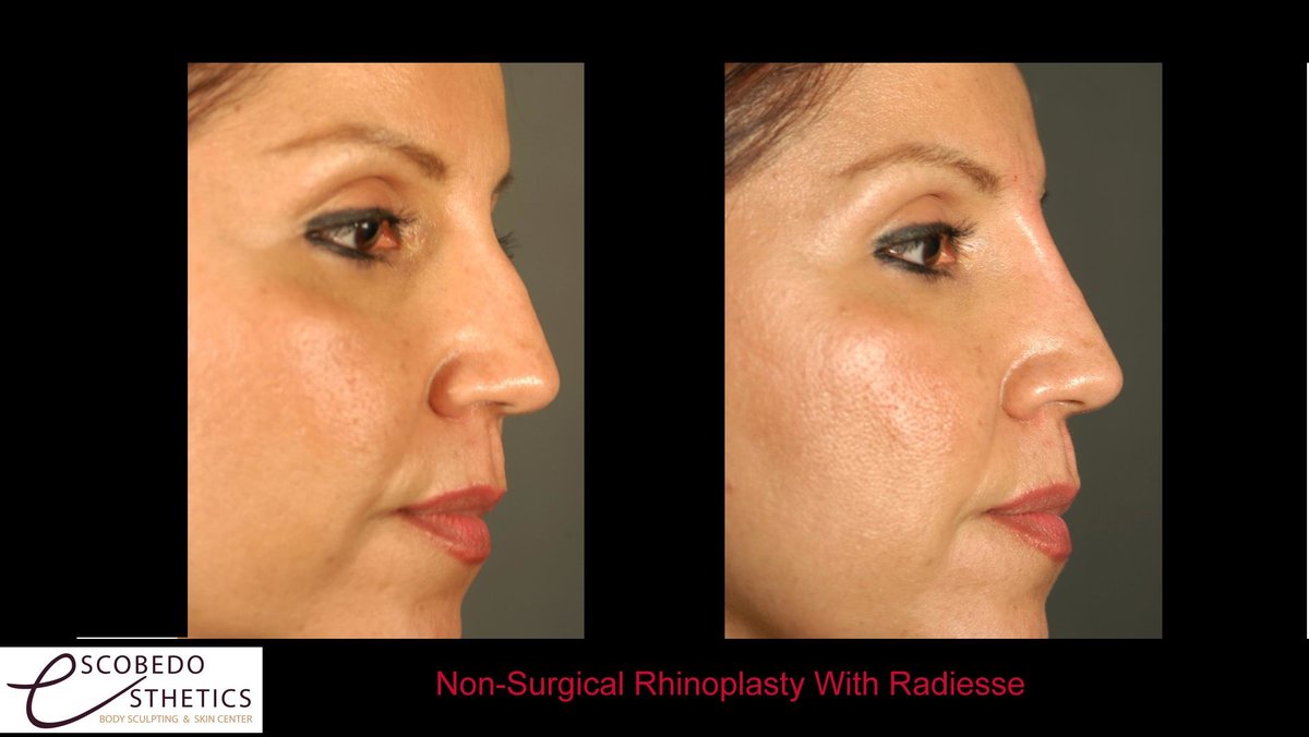 Escobedo Esthetics Body Sculpting & Skin Center - Escobedo Esthetics Body Sculpting & Skin Center