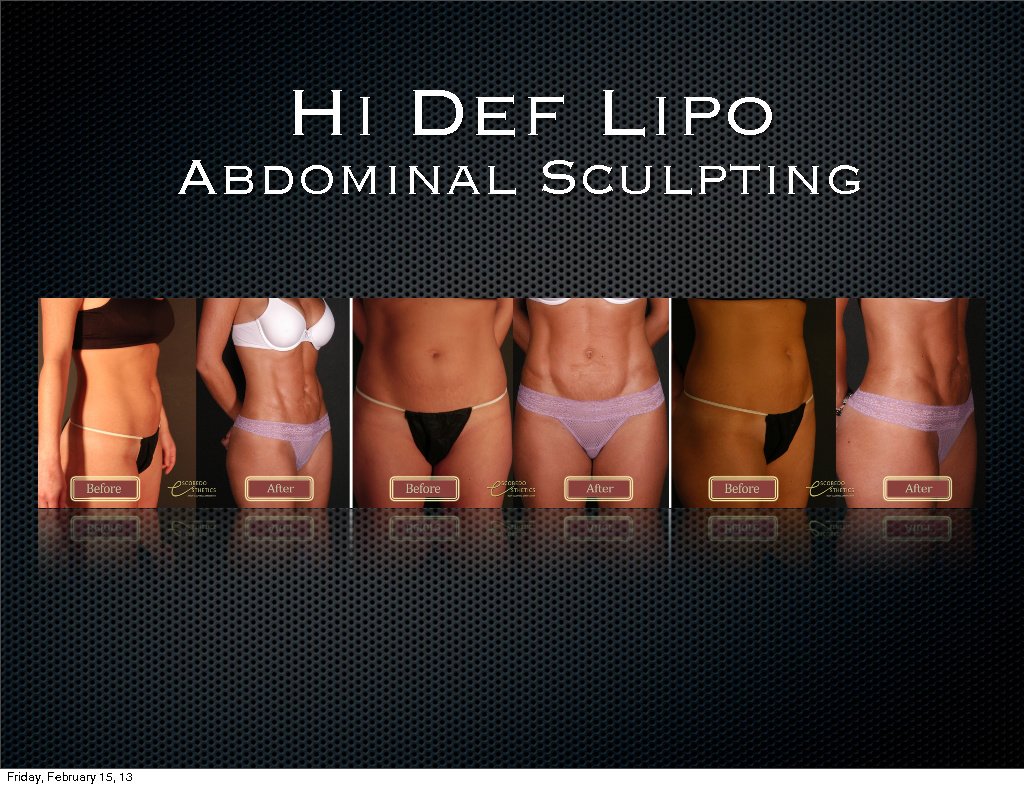 Escobedo Esthetics Body Sculpting & Skin Center - Escobedo Esthetics Body Sculpting & Skin Center