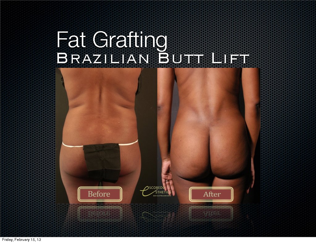 Escobedo Esthetics Body Sculpting & Skin Center - Escobedo Esthetics Body Sculpting & Skin Center