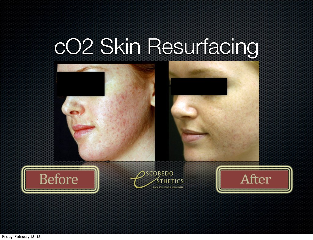 Escobedo Esthetics Body Sculpting & Skin Center - Escobedo Esthetics Body Sculpting & Skin Center