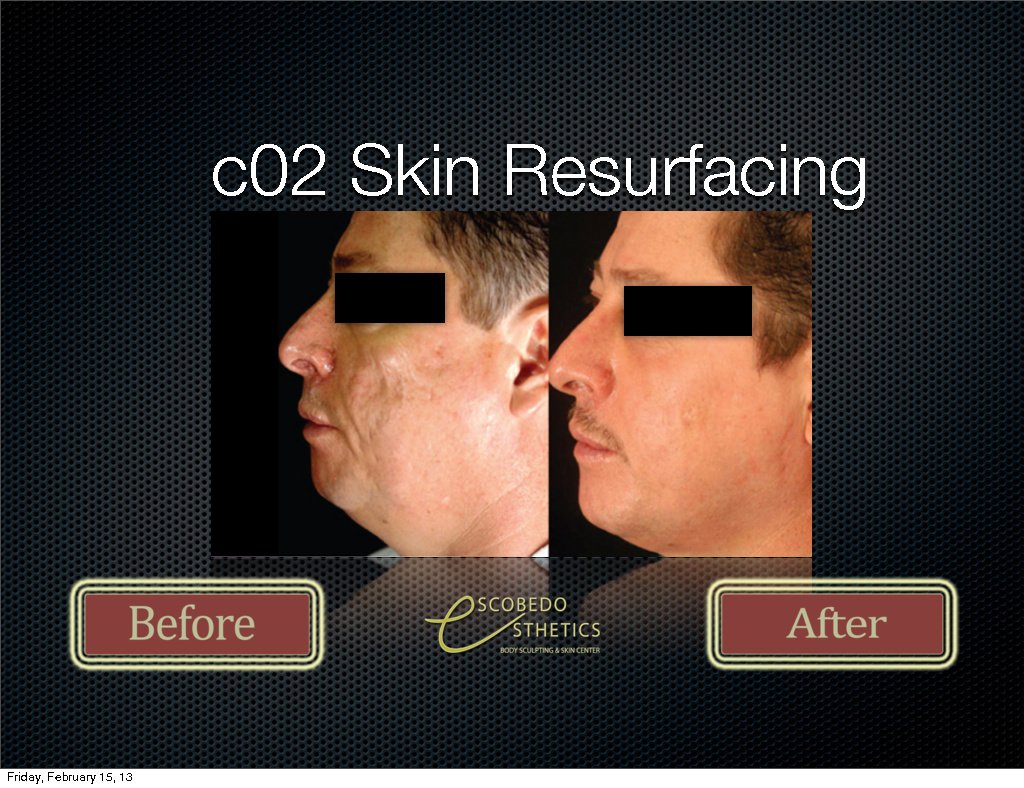 Escobedo Esthetics Body Sculpting & Skin Center - Escobedo Esthetics Body Sculpting & Skin Center