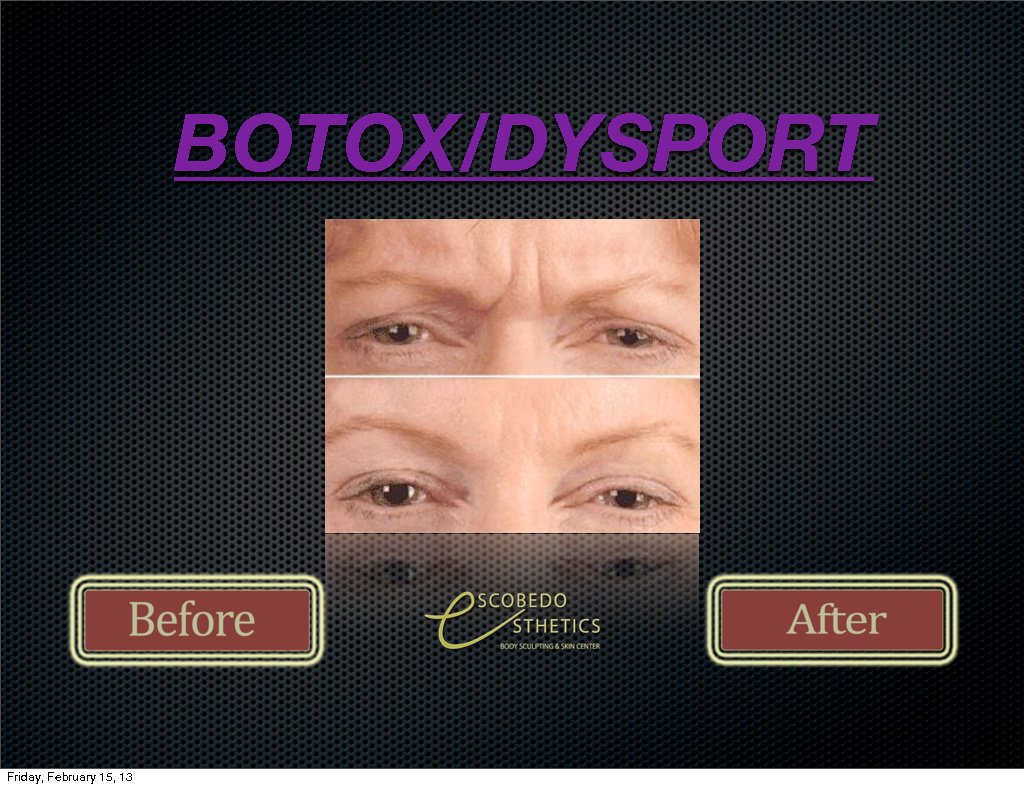 Escobedo Esthetics Body Sculpting & Skin Center - Escobedo Esthetics Body Sculpting & Skin Center