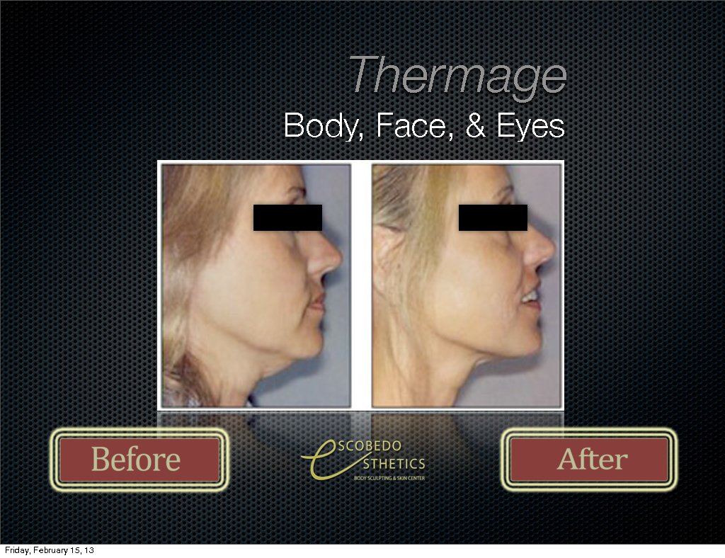 Escobedo Esthetics Body Sculpting & Skin Center - Escobedo Esthetics Body Sculpting & Skin Center