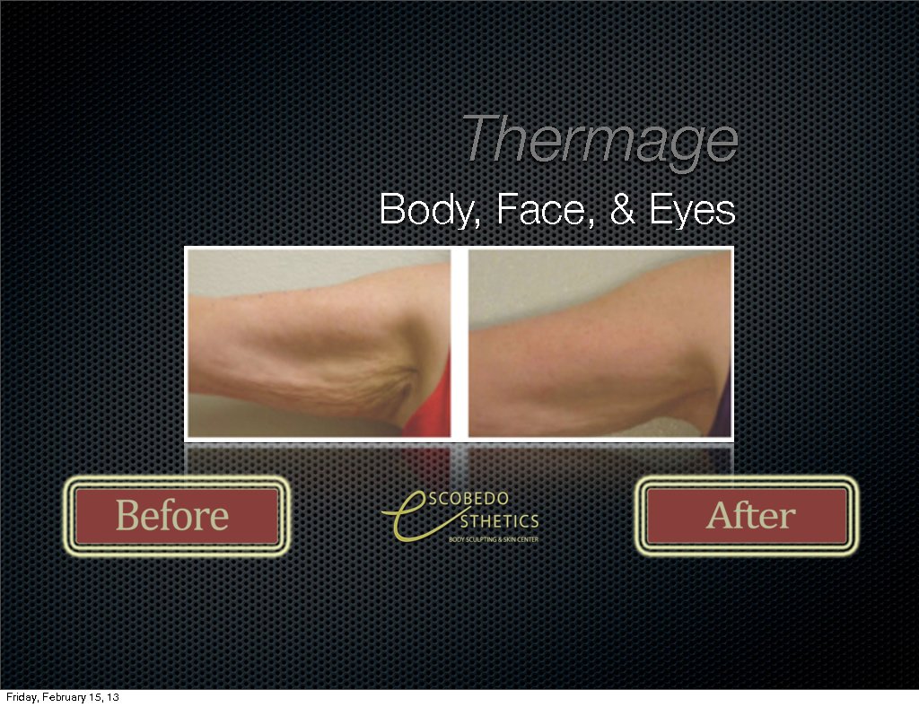 Escobedo Esthetics Body Sculpting & Skin Center - Escobedo Esthetics Body Sculpting & Skin Center