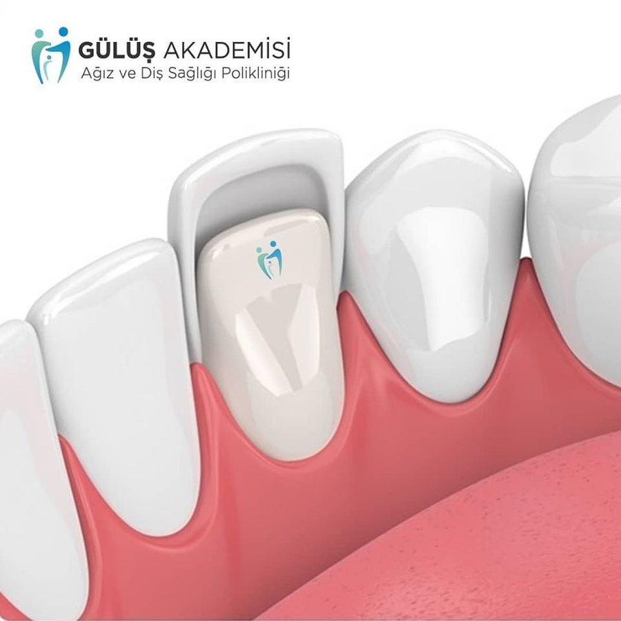 Eskişehir Gülüş Akademisi Ağız ve Diş Sağılığı Polikliniği (Smile Academy Dental Clinic Eskisehir) - Eskişehir Gülüş Akademisi Ağız ve Diş Sağılığı Polikliniği (Smile Academy Dental Clinic Eskisehir)