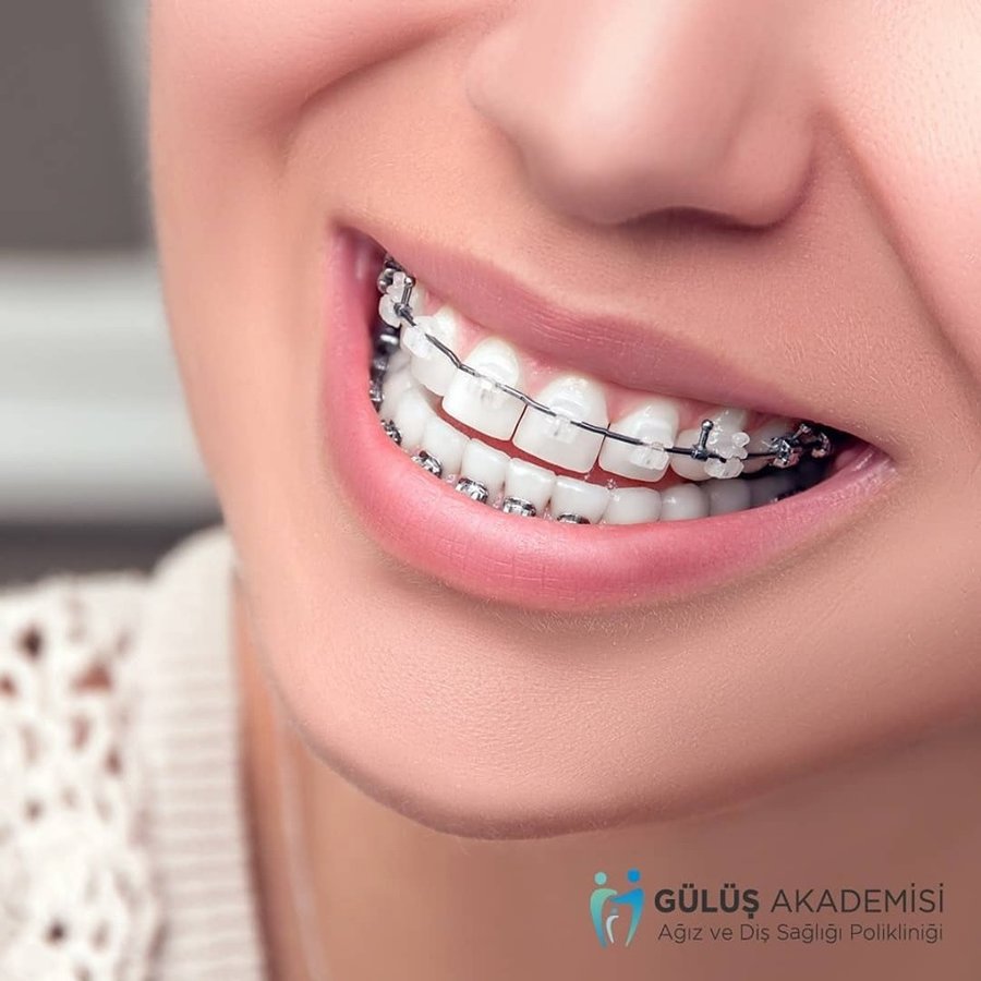 Eskişehir Gülüş Akademisi Ağız ve Diş Sağılığı Polikliniği (Smile Academy Dental Clinic Eskisehir) - Eskişehir Gülüş Akademisi Ağız ve Diş Sağılığı Polikliniği (Smile Academy Dental Clinic Eskisehir)