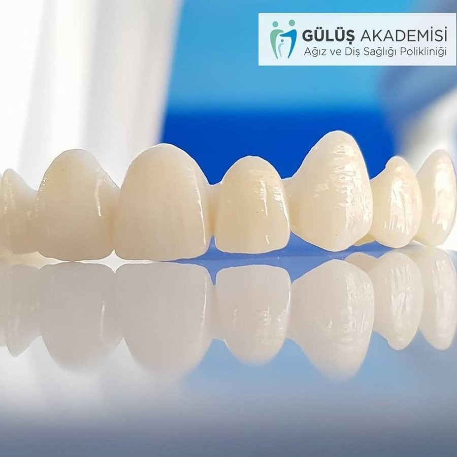 Eskişehir Gülüş Akademisi Ağız ve Diş Sağılığı Polikliniği (Smile Academy Dental Clinic Eskisehir) - Eskişehir Gülüş Akademisi Ağız ve Diş Sağılığı Polikliniği (Smile Academy Dental Clinic Eskisehir)