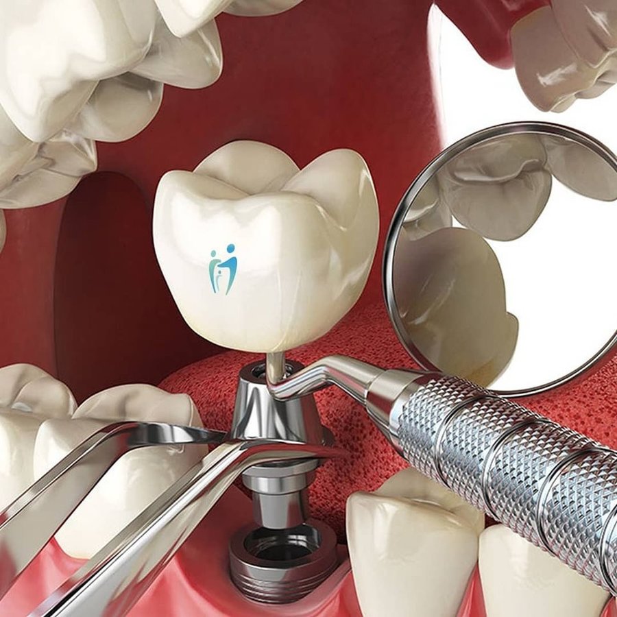 Eskişehir Gülüş Akademisi Ağız ve Diş Sağılığı Polikliniği (Smile Academy Dental Clinic Eskisehir) - Eskişehir Gülüş Akademisi Ağız ve Diş Sağılığı Polikliniği (Smile Academy Dental Clinic Eskisehir)