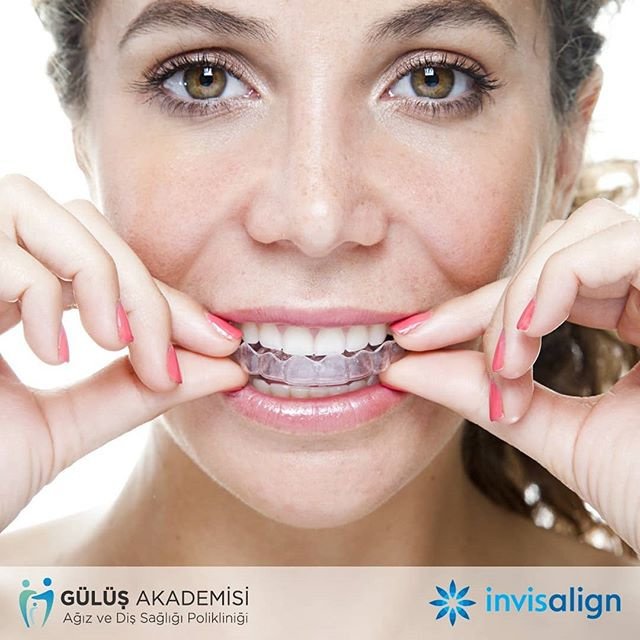 Eskişehir Gülüş Akademisi Ağız ve Diş Sağılığı Polikliniği (Smile Academy Dental Clinic Eskisehir) - Eskişehir Gülüş Akademisi Ağız ve Diş Sağılığı Polikliniği (Smile Academy Dental Clinic Eskisehir)