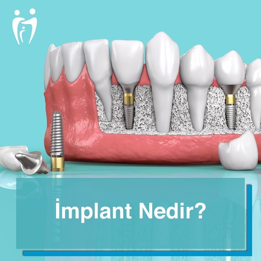 Eskişehir Gülüş Akademisi Ağız ve Diş Sağılığı Polikliniği (Smile Academy Dental Clinic Eskisehir) - Eskişehir Gülüş Akademisi Ağız ve Diş Sağılığı Polikliniği (Smile Academy Dental Clinic Eskisehir)