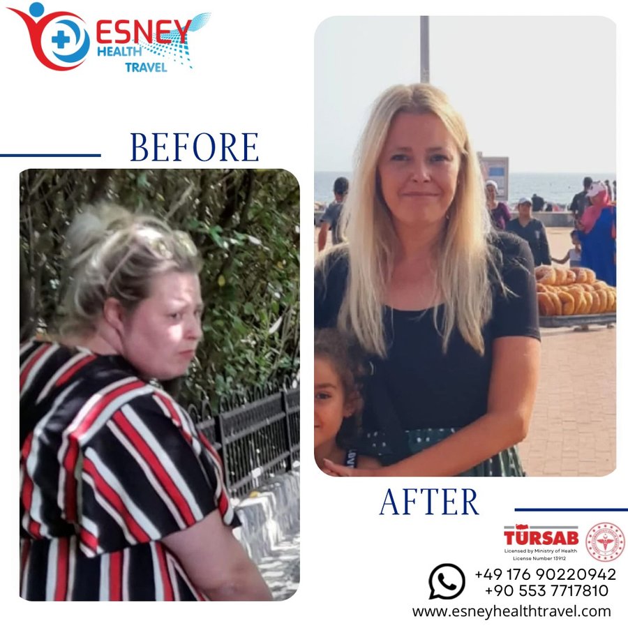 Esney Health Travel - Esney Health Travel