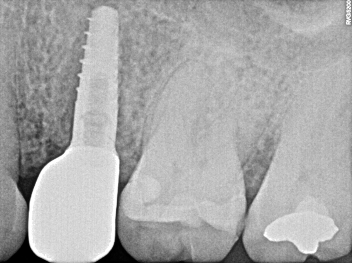Especialistas Dentales Internacional/ Dental Specialist International - Especialistas Dentales Internacional/ Dental Specialist International