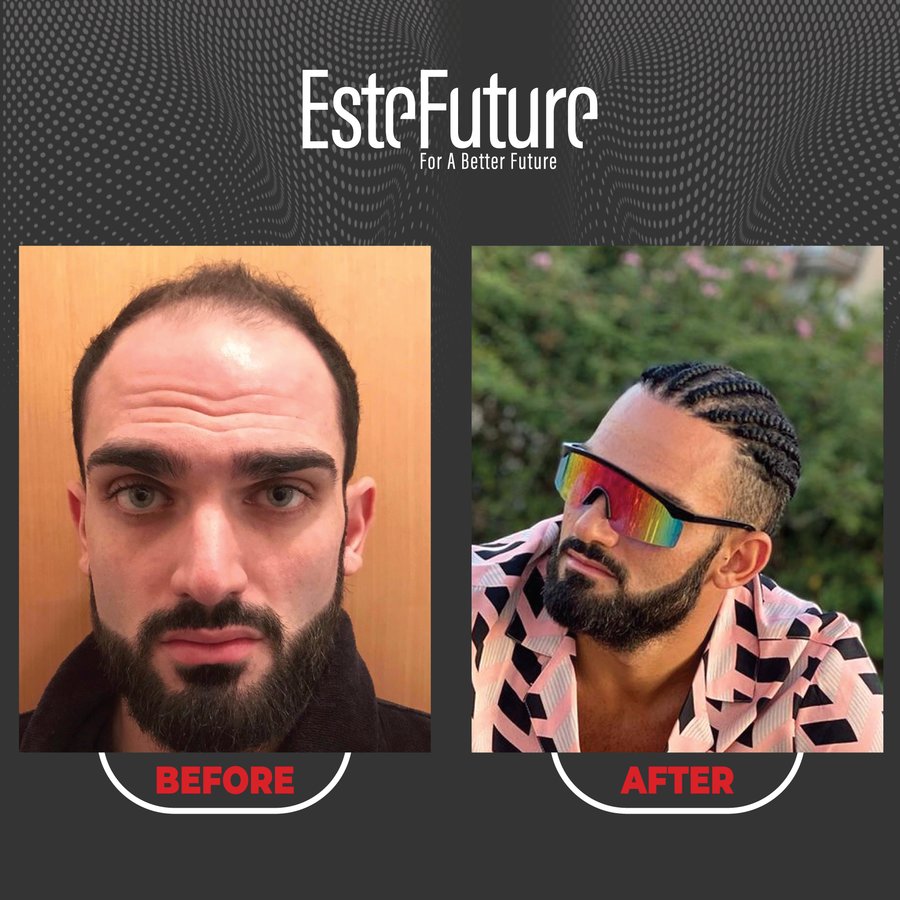 Este Future - Este Future