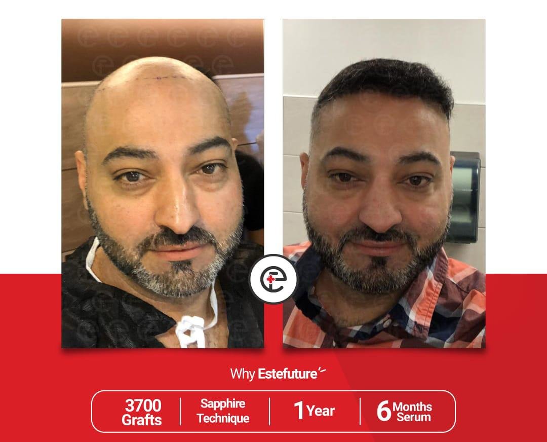 Este Future - Este Future