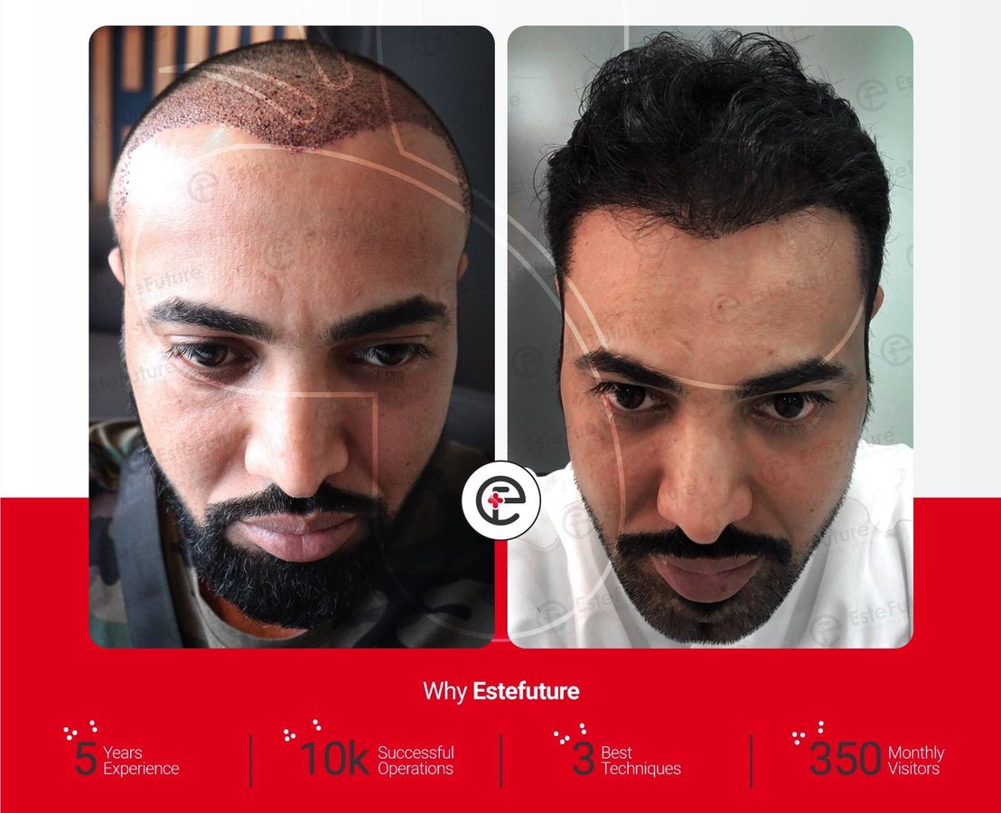 Este Future - Este Future