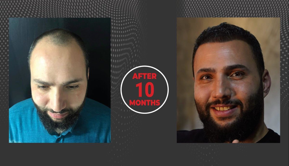 Este Future - Este Future