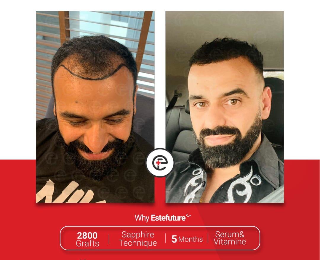 Este Future - Este Future