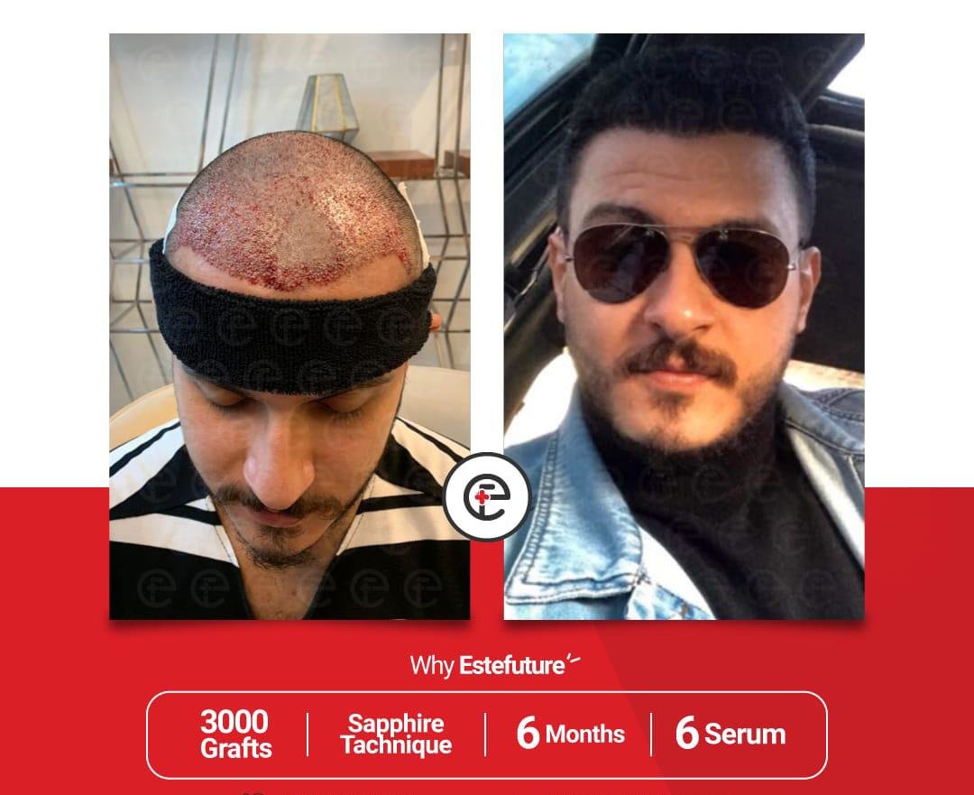 Este Future - Este Future