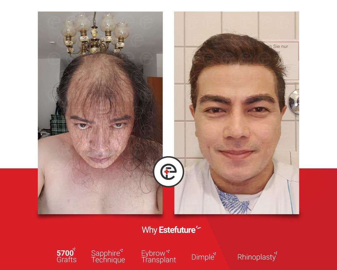 Este Future - Este Future