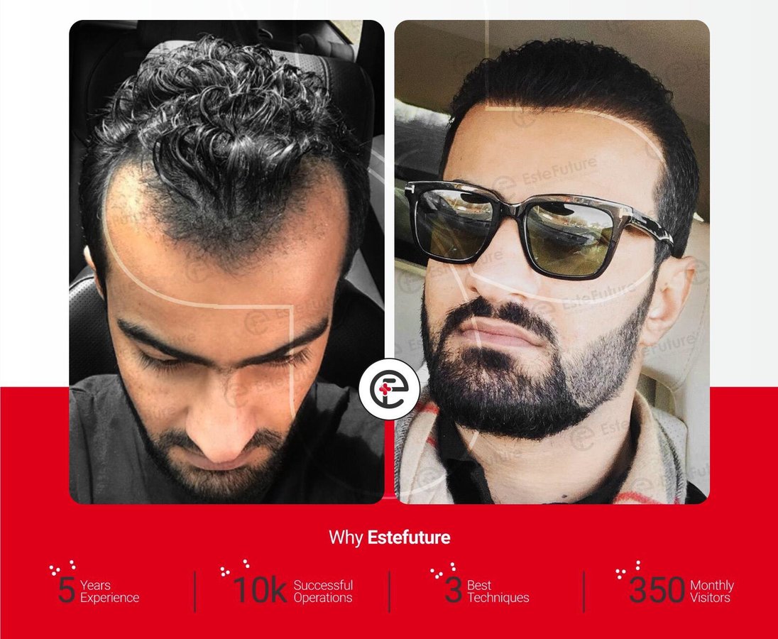 Este Future - Este Future