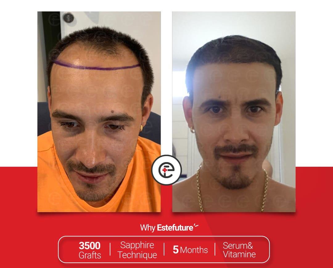 Este Future - Este Future